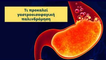 Γαστροοισοφαγική Παλινδρόμηση ΣΤΟΜΑΧΙ ΥΓΕΙΑ