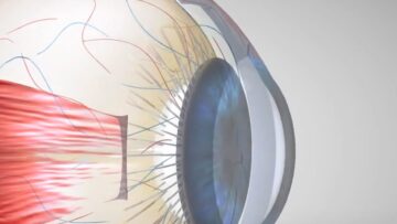 ματι  ΟΦΘΑΛΜΟς