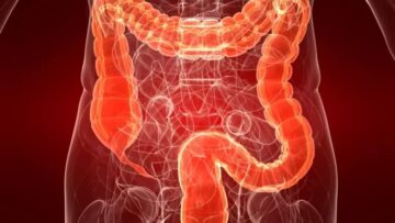 ΚΑΘΑΡΙΣΜΟ ΠΑΧΕΟΣ ΕΝΤΕΡΟΥ