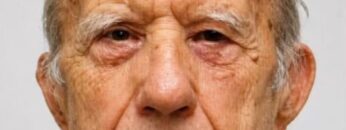 89_παπους_καραμπινα_εφκα_ilovepatrida