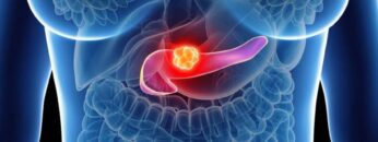 ΚΑΡΚΙΝΟΣ_ΠΑΓΚΡΕΑΣ_ilovepatrida